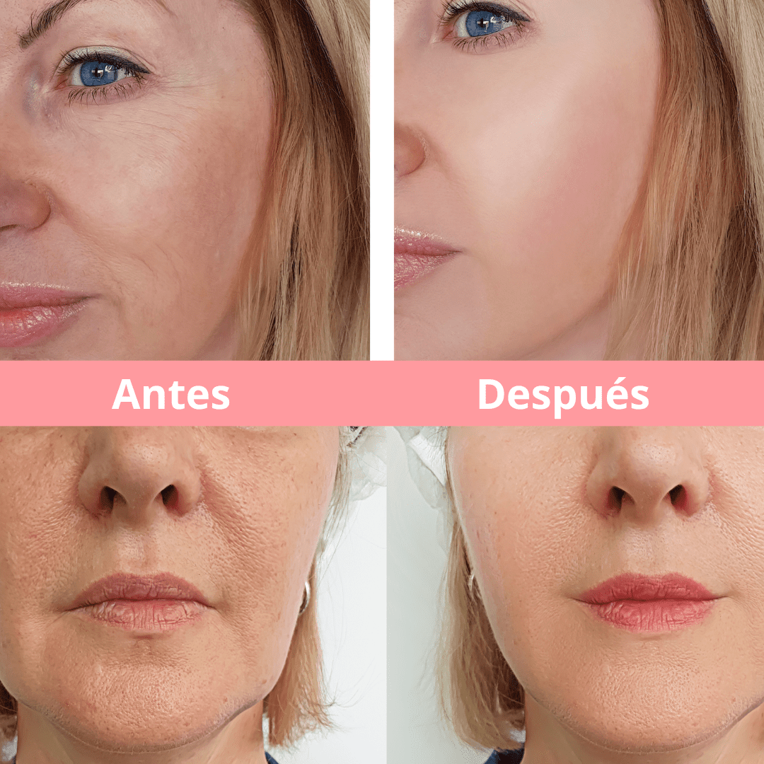 Reductor de Papada y Anti-Envejecimiento DivineSkin